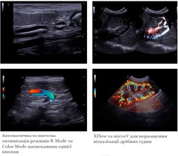 Демонстрація передових режимів візуалізації кровотоку на апараті MyLab X75 VET: автоматична оптимізація доплерівських режимів та використання технологій XFlow та microV для детального дослідження дрібних судин