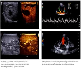 Приклади діагностичних зображень, отриманих на УЗД сканері MyLab X75 VET: проведення контрастного дослідження органів черевної порожнини та розширений пакет кардіологічних вимірювань з доплером