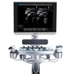 Великий план монітора ветеринарного УЗД-апарата Chison Qbit 7 Vet, на екрані якого відображаються 2 чорно-білих ультразвукових зображення плода в утробі. Під екраном розташована консоль управління