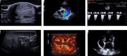 Клінічні ультразвукові зображення, отримані на апараті MyLab Sigma VET. Приклади включають: зображення органу в В-режимі, ехокардіограма, спектральний доплер, зображення з використанням розширених режимів