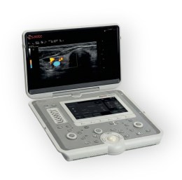 Портативний УЗД Esaote MyLab Sigma VET з відкритим екраном, що демонструє кольорове доплерівське картування судин на дисплеї. Пристрій має світло-сірий корпус, сенсорний екран та панель з кнопками та трекболом