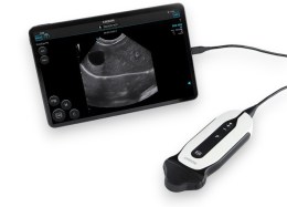 Портативний ветеринарний УЗД апарат CHISON SonoEye P6 Vet, підключений кабелем до планшета, що відображає результати сканування на екрані програми SonoEye