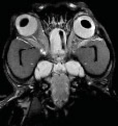 На зображенні показано МРТ-скан голови собаки в аксіальній площині на рівні очей та носової порожнини, демонструючи очні яблука, зорові нерви та навколоносові пазухи