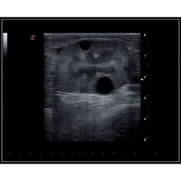 Ультразвукове чорно-біле зображення, що демонструє якість та контрасність, характерні для апарату MyLab x5 Vet. На знімку видно глибоку візуалізацію внутрішніх тканин з високою роздільною здатністю, що є результатом роботи технологій нового покоління