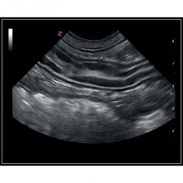 Ультразвукове зображення внутрішніх органів тварини, отримане за допомогою апарату MuLab x5 Vet. На знімку видно поперечний зріз кишечника з чіткою шаруватою структурою. Наявний вимірювальний маркер