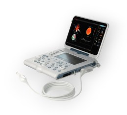 Esaote MyLab Alpha VET з відкритим монітором, що відображає кардіологічне дослідження (XStrain), та сенсорною панеллю. На фото видно підключений ультразвуковий датчик